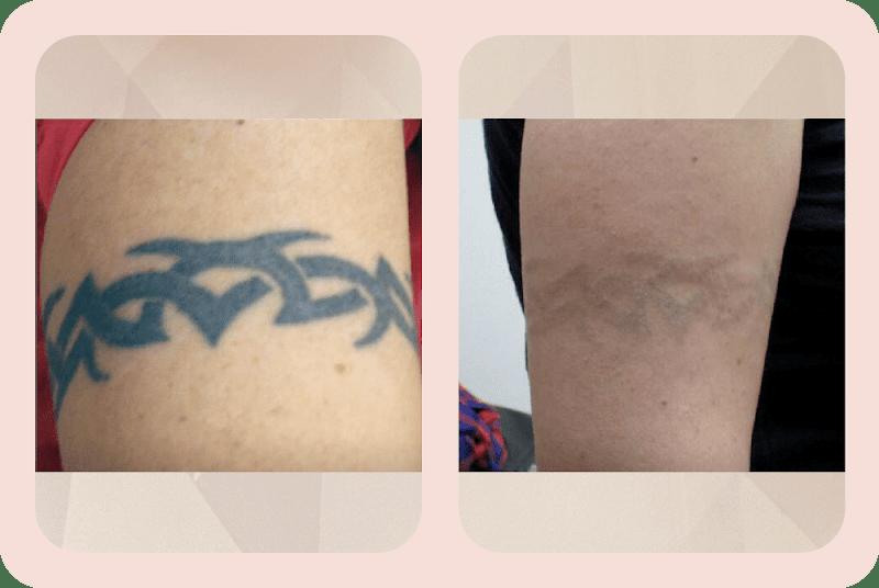 Dariro Tattoo - Photo 2
